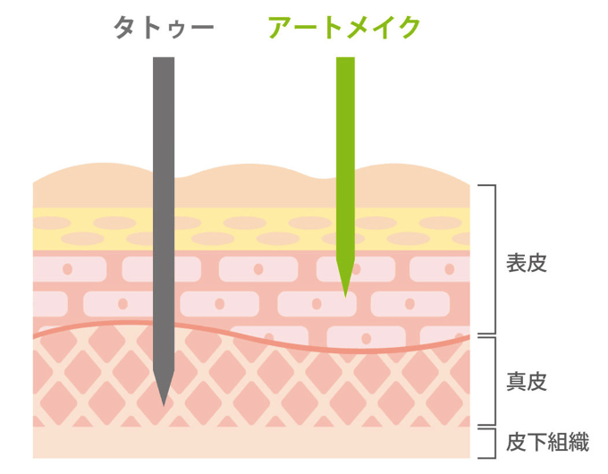 医療アートメイク